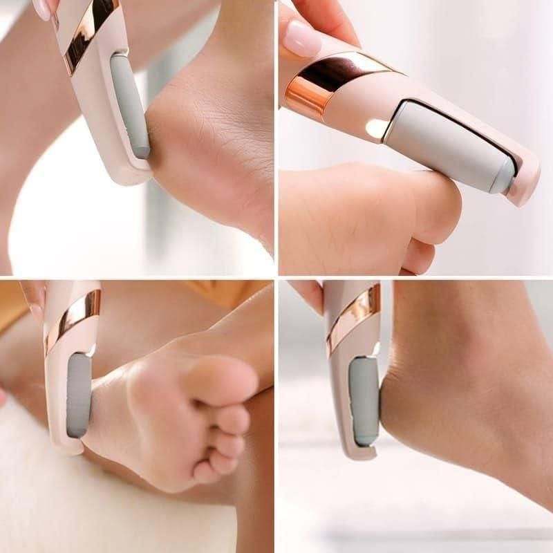 SilkSole™ - Cordless Pedicure Callus Dead Skin Remover