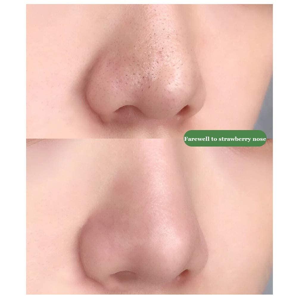 Blackheads Remover Green Tea Herbal Mask