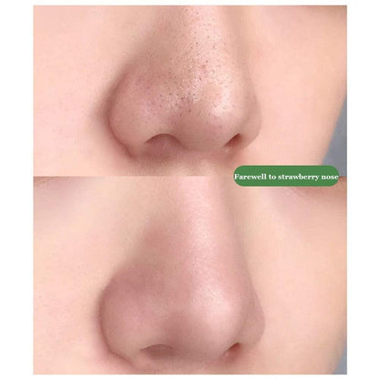 Blackheads Remover Green Tea Herbal Mask
